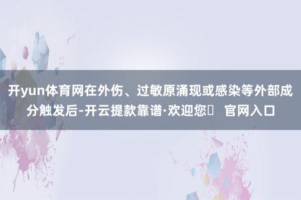 开yun体育网在外伤、过敏原涌现或感染等外部成分触发后-开云提款靠谱·欢迎您✅ 官网入口